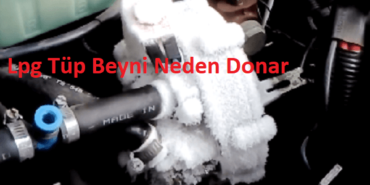 lpg-beyni-neden-donar-onlarnediyo