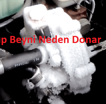 lpg-beyni-neden-donar-onlarnediyo