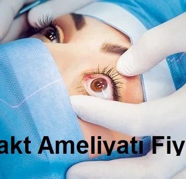 katarakt ameliyatı fiyatları
